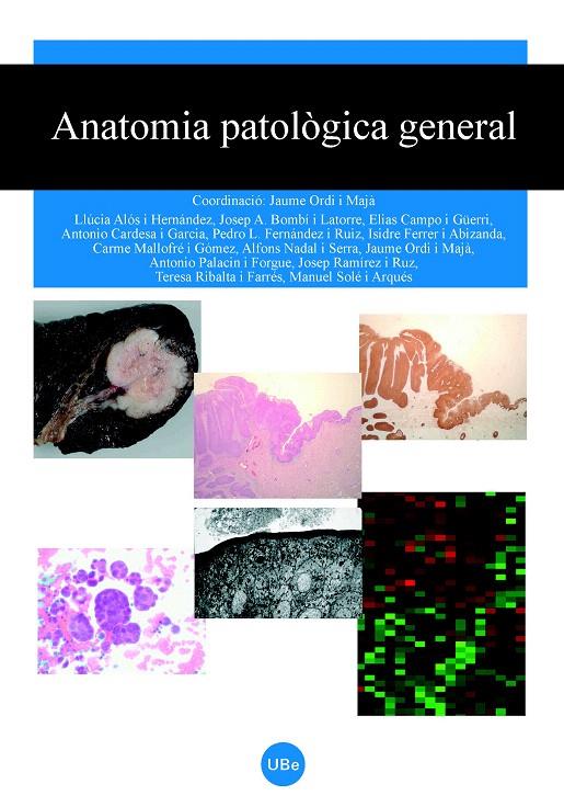 ANATOMIA PATOLOGICA GENERAL | 9788447531295 | VV.AA | Galatea Llibres | Llibreria online de Reus, Tarragona | Comprar llibres en català i castellà online