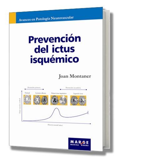 PREVENCION DEL ICTUS ISQUEMICO | 9788492442089 | MONTANER, JOAN | Galatea Llibres | Llibreria online de Reus, Tarragona | Comprar llibres en català i castellà online